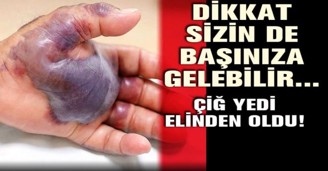 Esra Erol bir anda neye uğradığını şaşırdı!