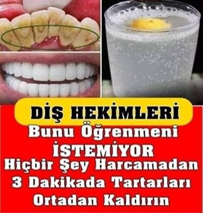 Evde diş beyazlatma yöntemleri nelerdir? Dişler nasıl beyazlatılır? galerisi resim 1