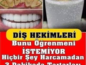 Evde diş beyazlatma yöntemleri nelerdir? Dişler nasıl beyazlatılır?