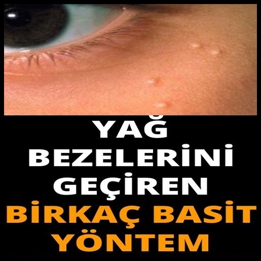 Yağ Bezesi (Lipom) Nasıl Geçer? 6 Doğal Destek galerisi resim 1