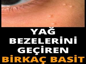 Yağ Bezesi (Lipom) Nasıl Geçer? 6 Doğal Destek