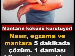 Nasır, egzama ve mantara 5 dakikada çözüm.