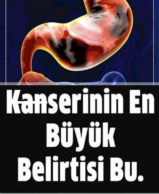 K'anser böyle başlar ve çok az kişi bilir. İ'şte o belirtiler galerisi resim 3