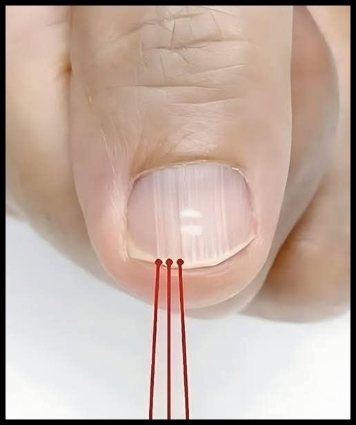 40 Yaşından Sonra Tırnağınızda Bu Çizgiler Varsa galerisi resim 1