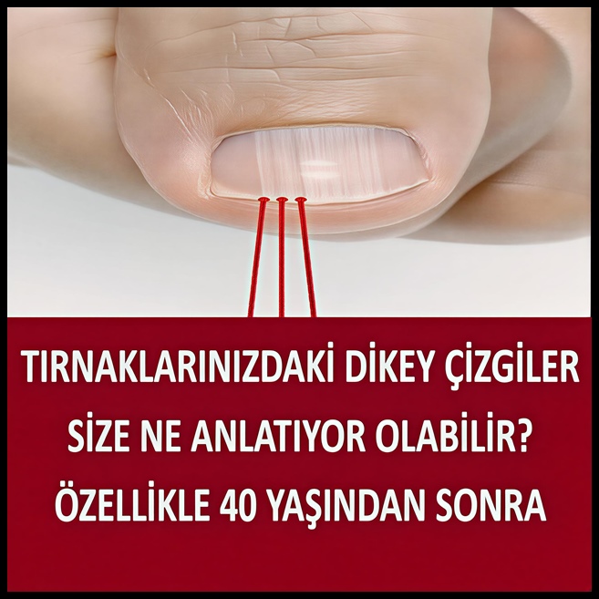 40 Yaşından Sonra Tırnağınızda Bu Çizgiler Varsa