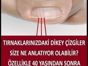 40 Yaşından Sonra Tırnağınızda Bu Çizgiler Varsa
