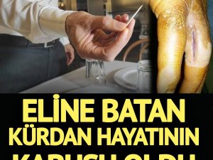 Eline batan kürdan kabusu oldu