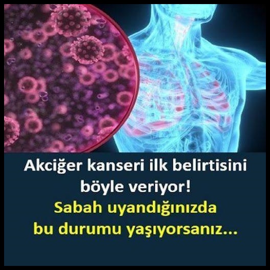 İşte akciğer kanserinin 12 belirtisii