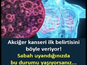 İşte akciğer kanserinin 12 belirtisii