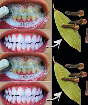 Sadece 2 dakikada tartarları çıkarın ve dişlerinizi beyazlatın. galerisi resim 2