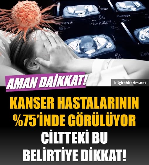 K'anser hastalarının %75'inde görülüyor