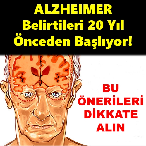 Alzheimer'in 12 belirtisi galerisi resim 1