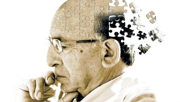 Alzheimer'in 12 belirtisi galerisi resim 4