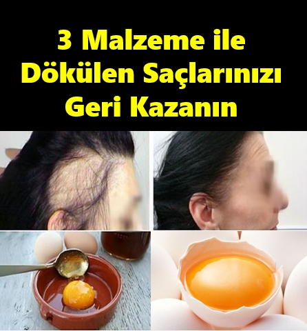 3 Basit Malzemeyle Dökülen Saçlarınızı Geri Kazanın! galerisi resim 1