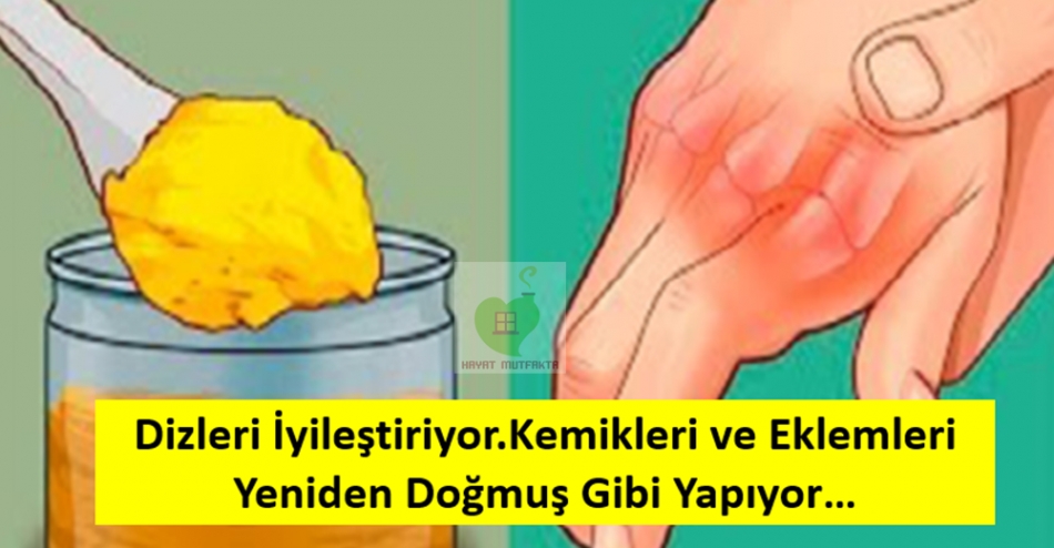 Dizleri ve Kemikleri İyileştiriyor galerisi resim 3