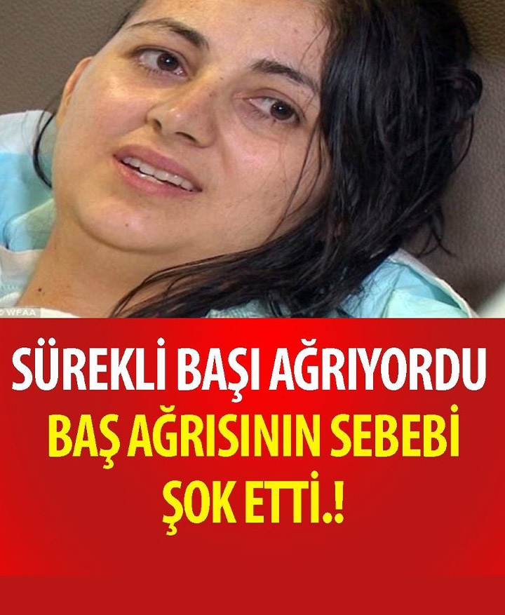 sürekli başı ağrıyan kadın doktora gitti vee.. galerisi resim 1