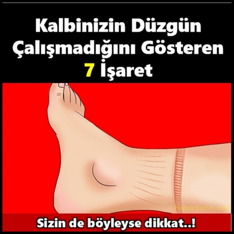 Kalbin Düzgün Çalışmadığını Gösteren 7 İşaret galerisi resim 1