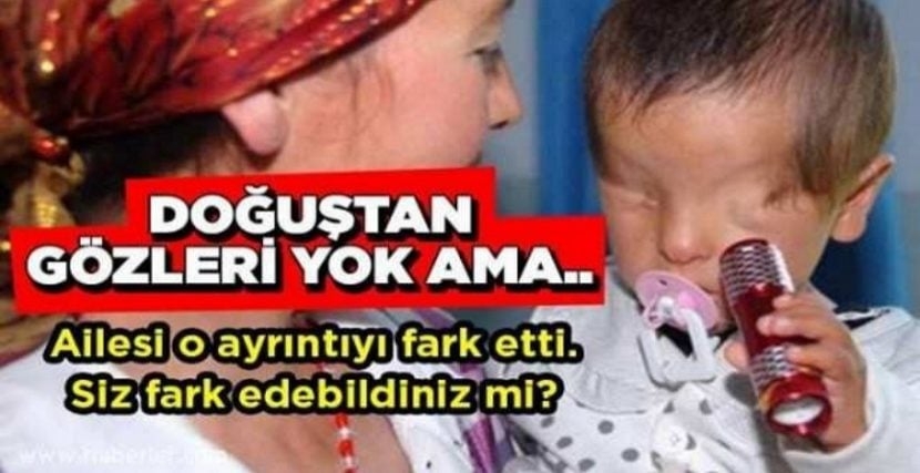 DOĞUŞTAN GÖZLERİ YOK, AMA AİLESİ O AYRINTIYI FARK ETTİ galerisi resim 1