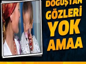 DOĞUŞTAN GÖZLERİ YOK, AMA AİLESİ O AYRINTIYI FARK ETTİ