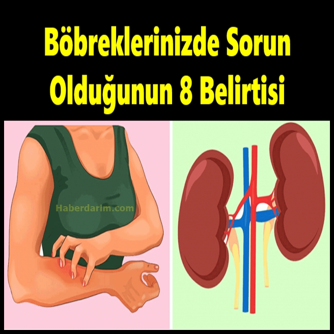 Böbreklerinizde Sorun Olduğunun 8 Belirtisi galerisi resim 1