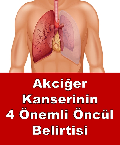 4 Önemli Öncül Belirtisi galerisi resim 1