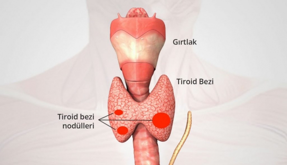 Tiroid Bozukluğuna İşaret Eden 14 Belirti galerisi resim 2