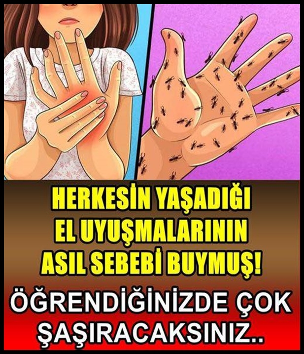 El Uyuşmasının Asıl Sebebi galerisi resim 1