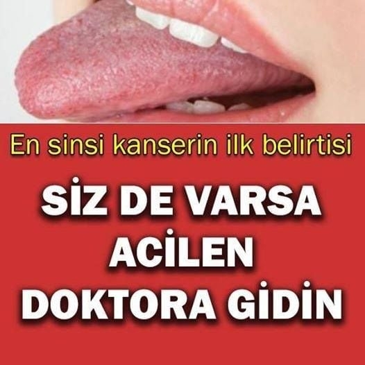 Sizde de olabilir galerisi resim 1