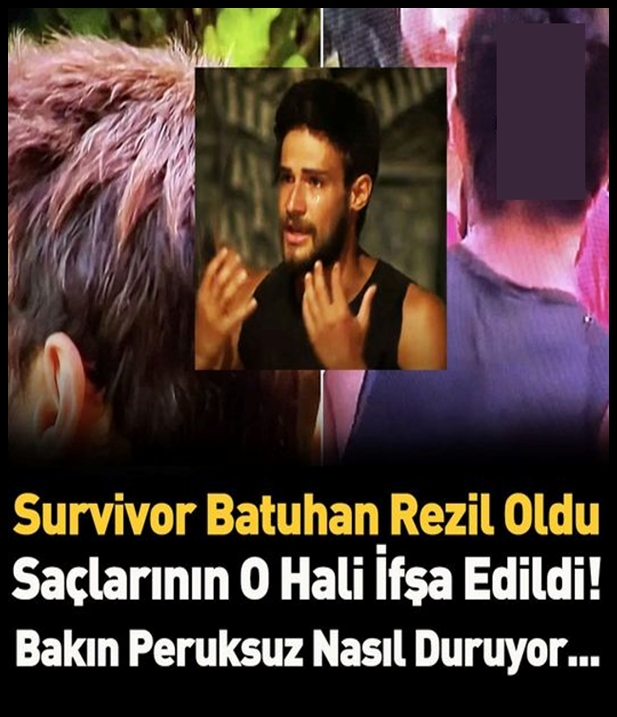 Survivor Batuhan rezil oldu. galerisi resim 1