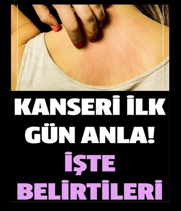 Kanserin İlk Belirtileri galerisi resim 1