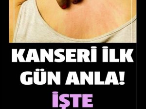 Kanserin İlk Belirtileri