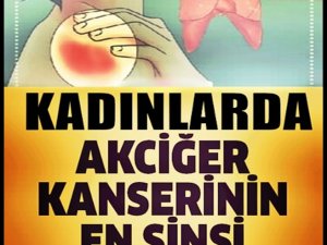 Akciğer kanserinin 9 önemli belirtisine dikkat!