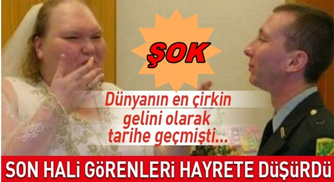 DÜNYANIN EN ÇİRKİN GELİNİ' ADINI ALMIŞTI SON HALİ GÖRENLERİ ŞAŞIRTTI.