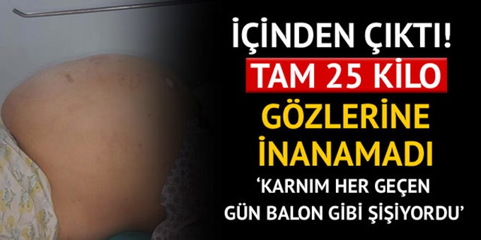 Karnından çıktı! 25 kilo ağırlığında..