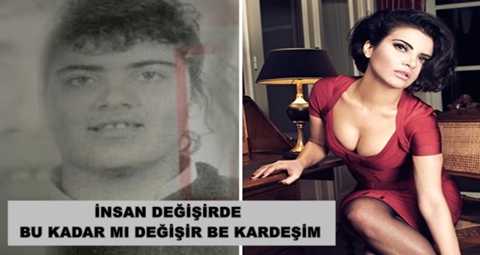 Vay bee! İnsan Bu Kadarmı Değişir Be Kardeşim Dedirten Ünlüler