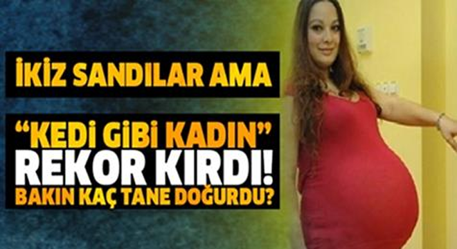 İkiz Bebek Bekliyordu. Doğuma Gittiğinde Her Şey Çok Farklı Oldu