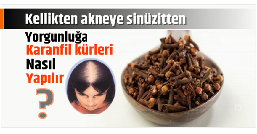 Kellikten sivilceye sinüzitten yorgunluğa karanfil kürleri nasıl yapılır