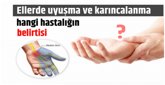 Ellerde uyuşma ve karıncalanma hangi hastalığın belirtisi?