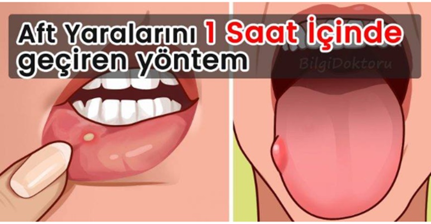 1 Saat İçinde Ge-çiren Yön-tem