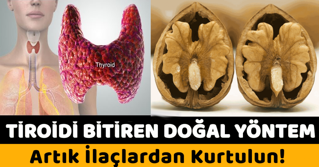 Tiroid Hastalarına İlaçsız Doğal Çözüm