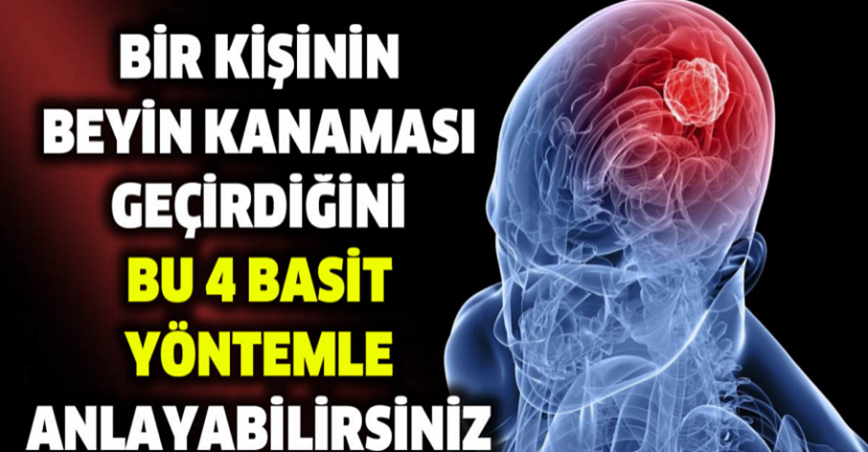 Bir kişinin beyin kanaması geçirdiğini bu dört basit yöntemle anlayabilirsiniz