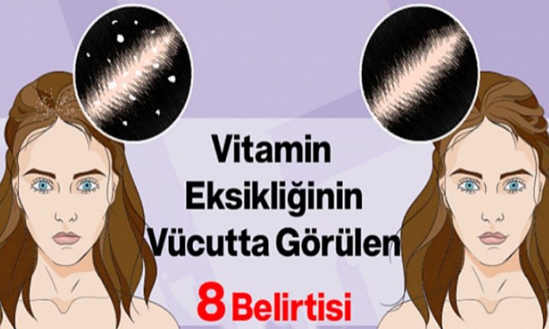 Vitamin Eksikliğinin Vücutta Görülen 8 Belirtisi