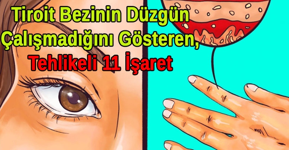 Tiroit |Bezinin Düzgün Çalışmadığını Gösteren, İhmal Etmesi Tehlikeli Olabilecek 11 İşaret