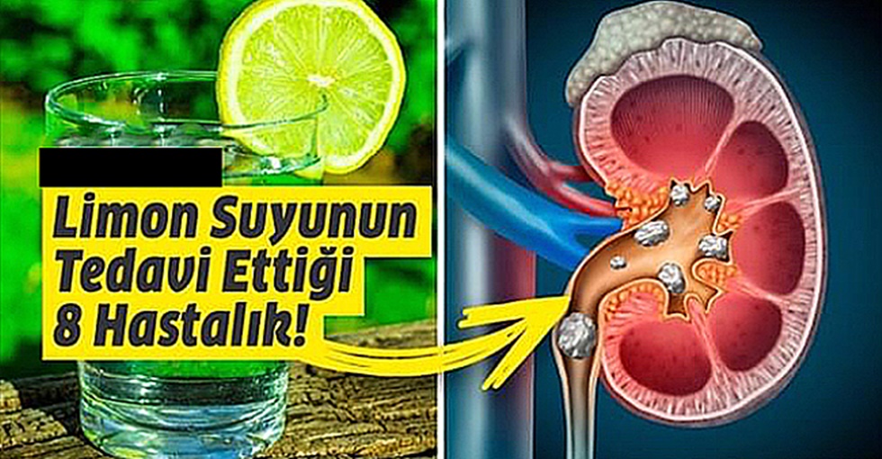 Lim-on Suyu Neye İyi Gelir? Limon Suyu İle Tedavi Edebile-ceğiniz 8 Sağlık Pro-blemi