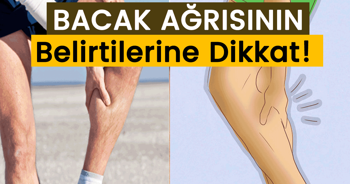 Baldır Kısmında Ağrı