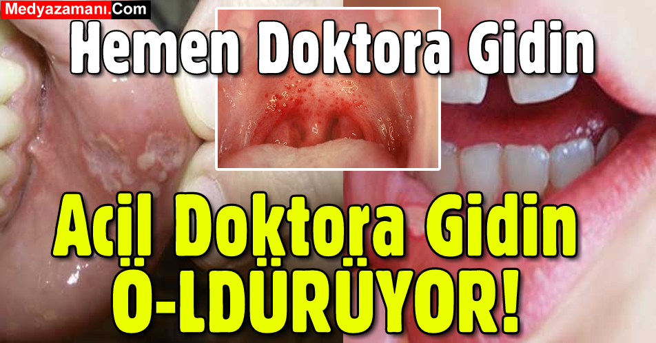 Dikkat! Herkeste Çıkmaya Başladı: Acil Doktora Gidin... Bu Sandığınız Şey Değil