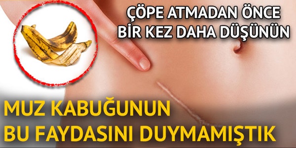 BU FAYDASINI KİMSE BİLMİYORDU. OKUDUKTAN SONRA MUZ'UN KABUĞUBU ASLA ÇÖPE ATMAYACAKSINIZ..