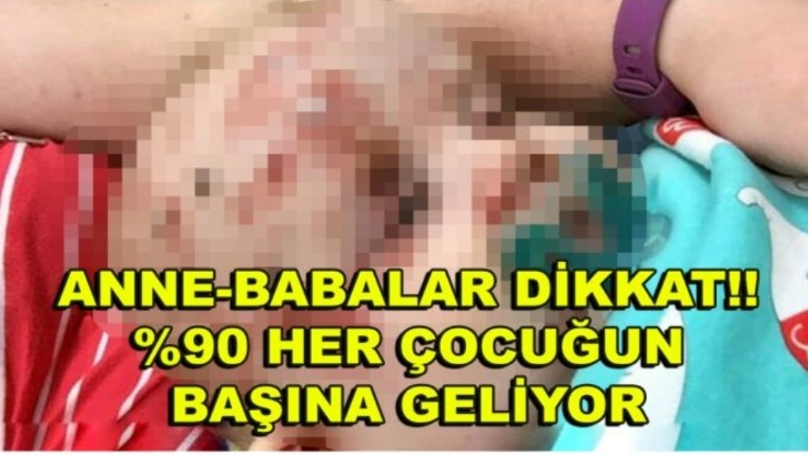 BEBEĞİN SURATINDA YARALAR ÇIKTI ANNE NEDENİNİ ÖĞRENİNCE KAHROLDU