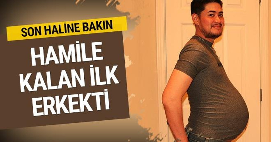 HAMİLE KALAN İLK ERKEKTİ! BİR DE SON HALİNE BAKIN