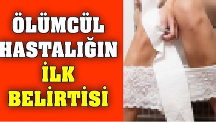 WC ' DE BU SORUNU YAŞIYORSANIZ MUTLAKA DOKTORA GİDİN